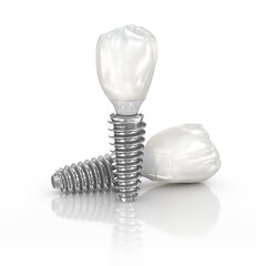 Dental implant and ceramic crown on white background. 3D illustration. - obrazy, fototapety, plakaty