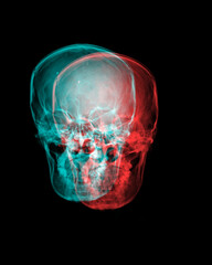 X-ray film of the skull double color.