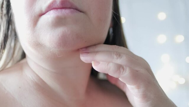 close up part face mature woman 55 years old, human fat neck, side view, double saggy chin, deep wrinkles, age-related skin changes, cosmetic anti-aging procedures, skin tightening
