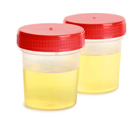 Containers with urine samples for analysis on white background