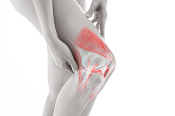Knee pain, meniscus inflamed, human leg medically accurate representation of an arthritic knee...