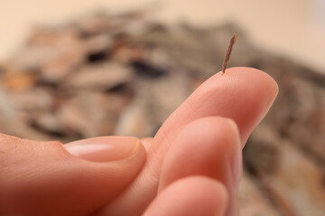 Woman with splinter in her finger on blurred background, closeup