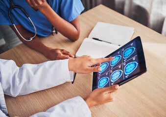 Doctor, tablet and brain xray, neurology and digital test results, people and healthcare team in...