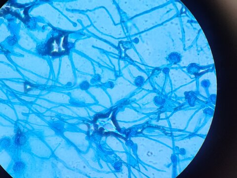 Aspergillus conidiophores stained with lactophenol cotton blue