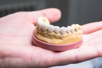 A jaw with ceramic teeth. Dentist's device in the hand. Close-up