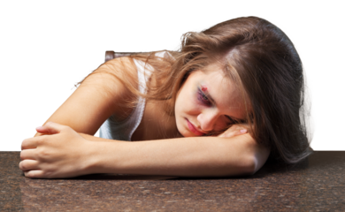 bruised young woman; victim of domestic abuse
