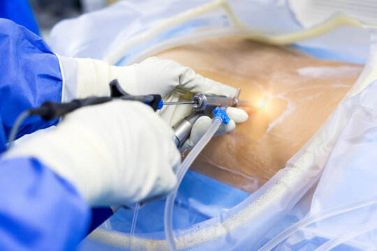 Selective focus with blur background.Surgeon picking up surgical instruments for doctor inside operating room in hospital.Doctor in blue uniform does minimal invasive endoscopic keyhole spine surgery.