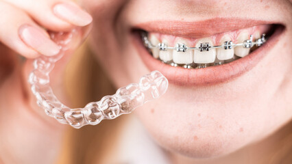 Dental care.Smiling girl with braces on her teeth holds aligners in her hands and shows the...
