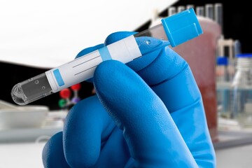 Hand with blood test tube for sample