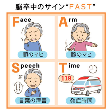 脳卒中チェックFASTの説明イラスト2