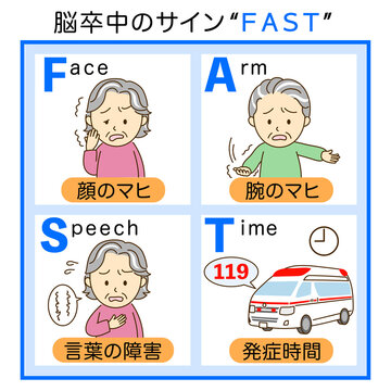 脳卒中チェックFASTの説明イラスト１