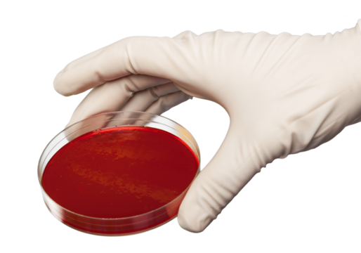 Glass Petri dishes in arm with chemical