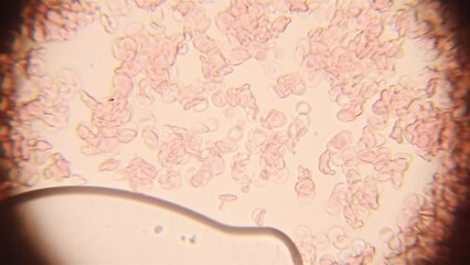 Part of the lens is blurred on the sides. Blood cells are moving in liquid. Close up view under the microscope. - Powered by Adobe