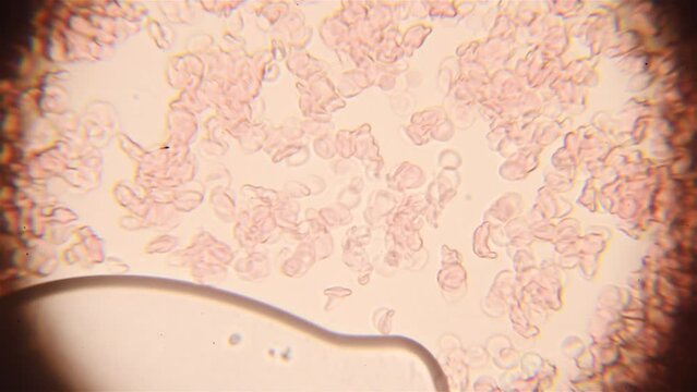 Part of the lens is blurred on the sides. Blood cells are moving in liquid. Close up view under the microscope.