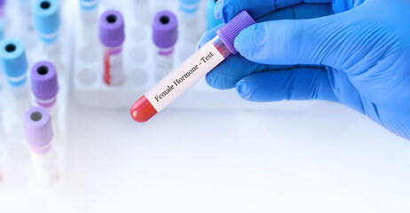Naklejka premium Doctor holding a test blood sample tube with female hormone test on the background of medical test tubes with analyzes.Copy space for text