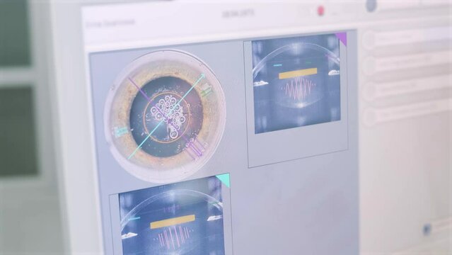 Femto Laser Assisted Cataract Surgery.