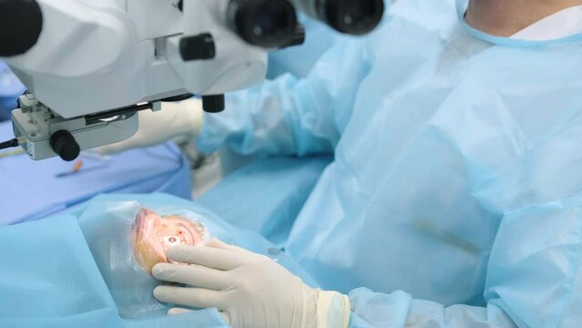 Ophthalmological surgery specialist sits in front of microscope performing operation. Low angle view on the female doctor conducting high-precision surgery. Femto Laser Assisted Cataract Surgery.