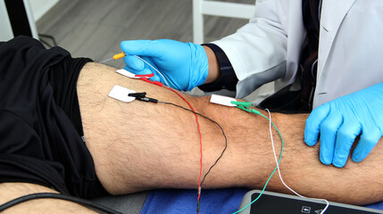 Electromyography EMG and Somatosensory Evoked Potential PEV of lower extremities, neurophysiological test applies electrical stimuli near the nerves to explore the rectus femoris muscle