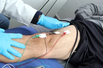Fotobehang Electromyography EMG and Somatosensory Evoked Potential PEV of lower extremities, neurophysiological test applies electrical stimuli near the nerves to explore the rectus femoris muscle © Arlette