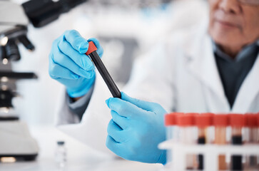 Blood, test tube and hands of scientist in laboratory with sample for research, medical study and...