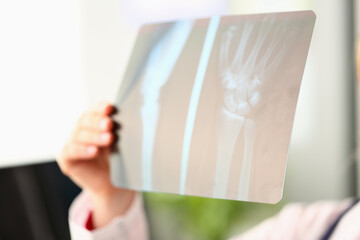 Doctor holds in hands an x-ray of arm
