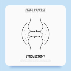 Synovectomy thin line icon. Knee surgery, arthritis. Joint inflammation. Pixel perfect, editable stroke. Vector illustration.