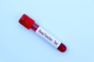renal function test to look for abnormalities from blood