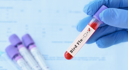 Naklejka premium Doctor holding a test blood sample tube positive with Bird Flu test on the background of medical test tubes with analyzes.