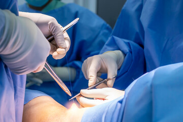Doctor in blue uniform do surgery inside operating room in orthopedic hospital.Surgeon made suture...