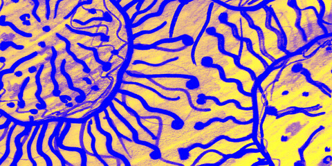 Cancer Abstract Background. Bright Clear Cells.