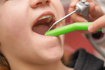 The girl is sitting on a dental chair, the doctor performs various manipulations in the girl's...