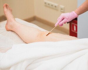 Preparing and conducting a laser hair removal procedure on the skin in a beauty salon - aesthetic medicine for beauty