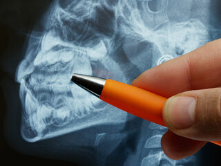 closeup dental x-ray of child