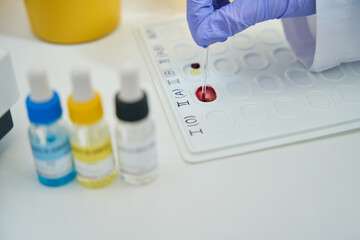 Fototapeta premium Hematologist works with blood samples on an indication palette