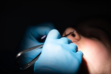 Close up of girl with brackets receiving dental braces treatment in clinic