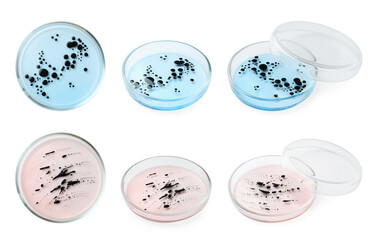 Collage of Petri dishes with bacteria culture on white background, different angles