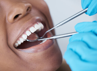 Checkup, mouth and woman at the dentist for dental care, healthcare and search for cavities....