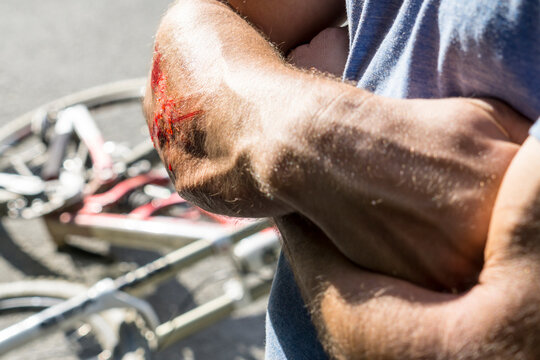 Injury