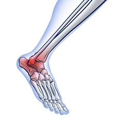 An illustration of a running skeletal line showing a red dot indicating an injury. medical use educational and scientific
