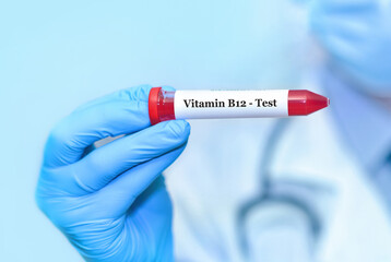 Doctor holding a test blood sample tube with Vitamin B12 test.