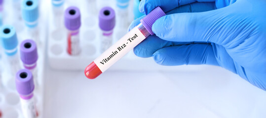Doctor holding a test blood sample tube with Vitamin B12 test on the background of medical test...
