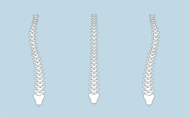 human spine in normal and with scoliosis