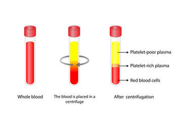 Platelet-rich plasma (prp). Autologous conditioned plasma, is a concentrate of platelet-rich plasma extracted from whole blood. After centrifugation, Extract PRP and Inject. Vector Illustration