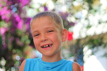 Cute boy without front teeth laughs. Changing teeth and hygiene. Dentist's Dream