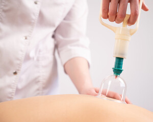 Female massage therapist uses vacuum cans on the patient's back. 