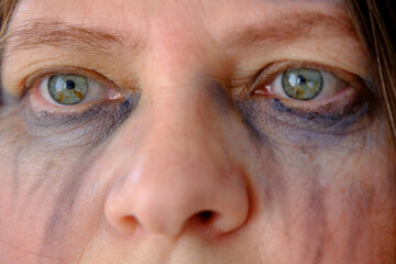 close-up of female tear-stained face, beaten woman with bruises and abrasions, quiet cry for help,...