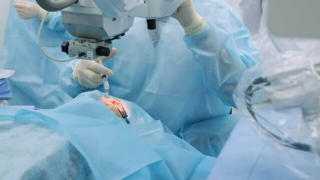Ophthalmological surgery specialist sits in front of microscope performing operation. Low angle view on the female doctor conducting high-precision surgery. Femto Laser Assisted Cataract Surgery.