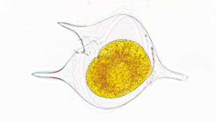 Protoperidinium sp, a marine phytoplankton from dinoflagelate group. Lugol-preserved sample. 400x...