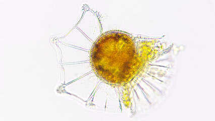 Ornithocercus, a marine dinoflagelate armored with overlapping cellulose plates. Lugol-preserved...