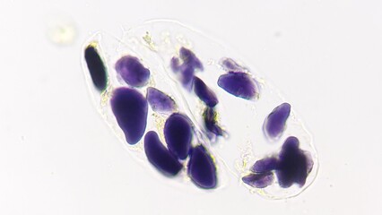 Starch grains in banana cells under the microscope. Starch is stained by lugol. 400x magnification